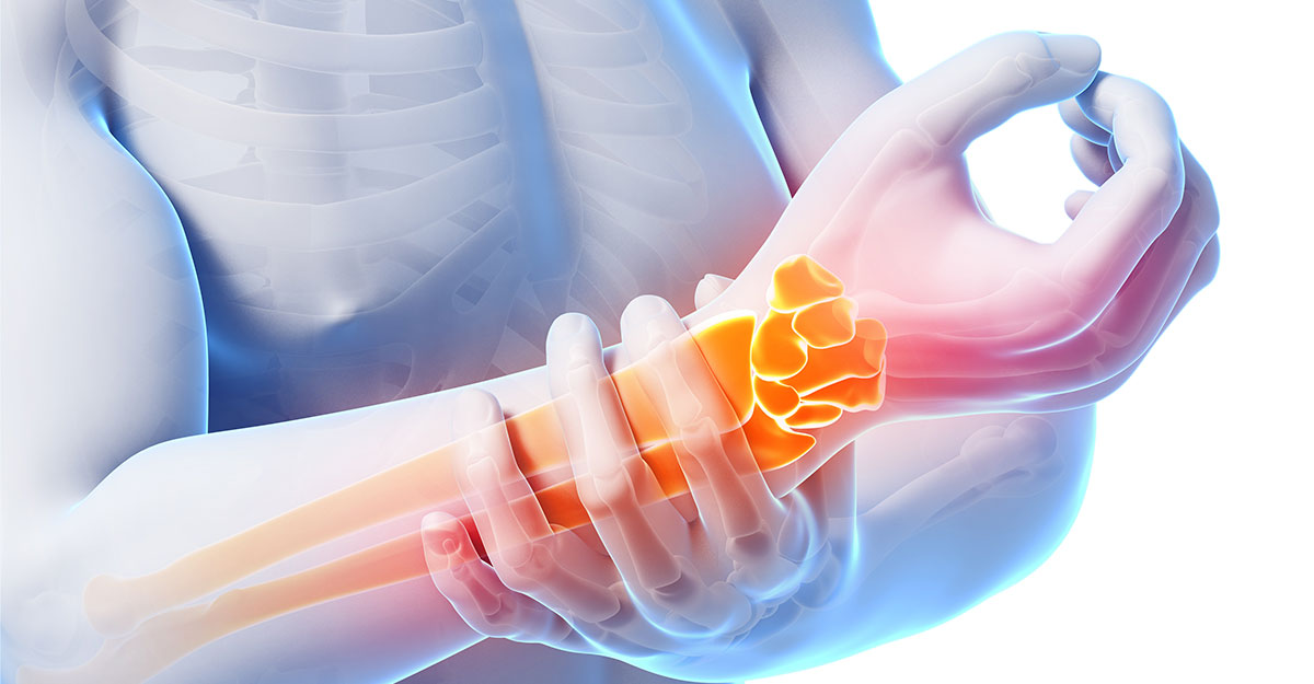 Jacksonville natural carpal tunnel treatment