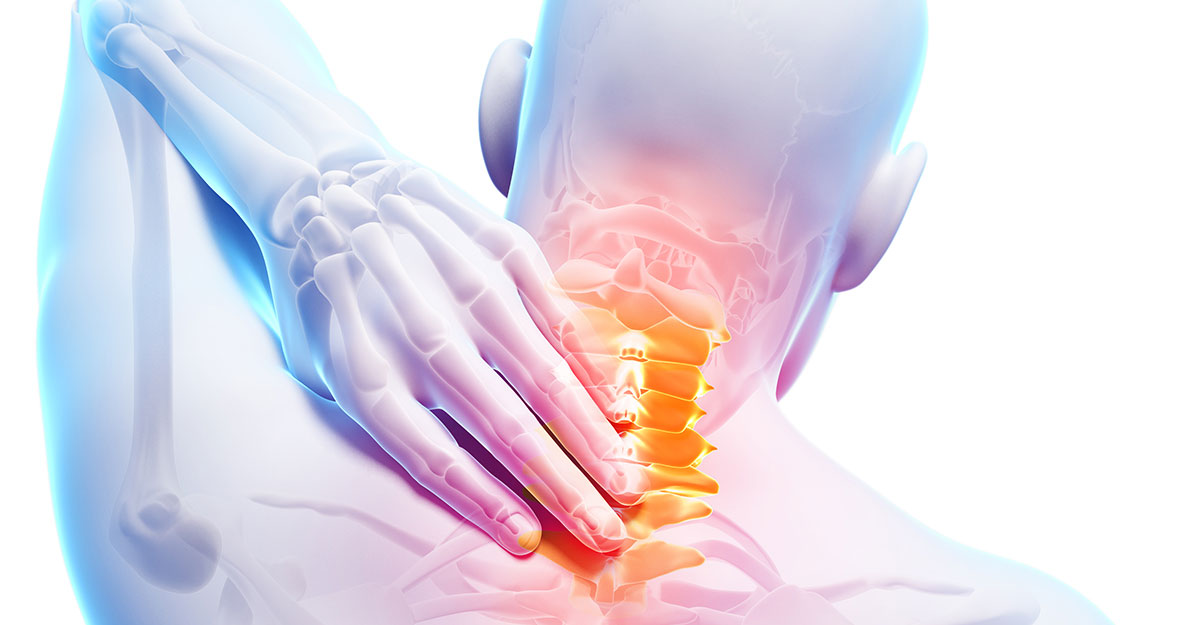 Jacksonville, FL neck pain and headache treatment