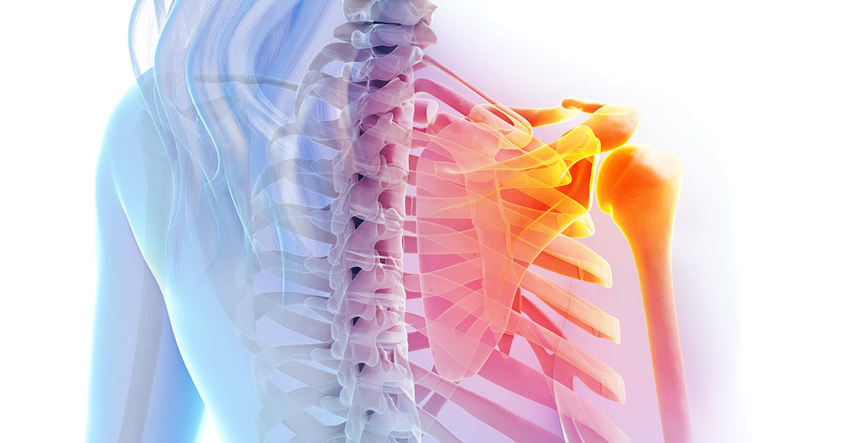 Jacksonville, FL shoulder pain treatment and recovery