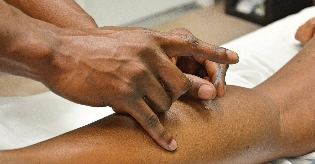 Dry needling in Jacksonville, FL